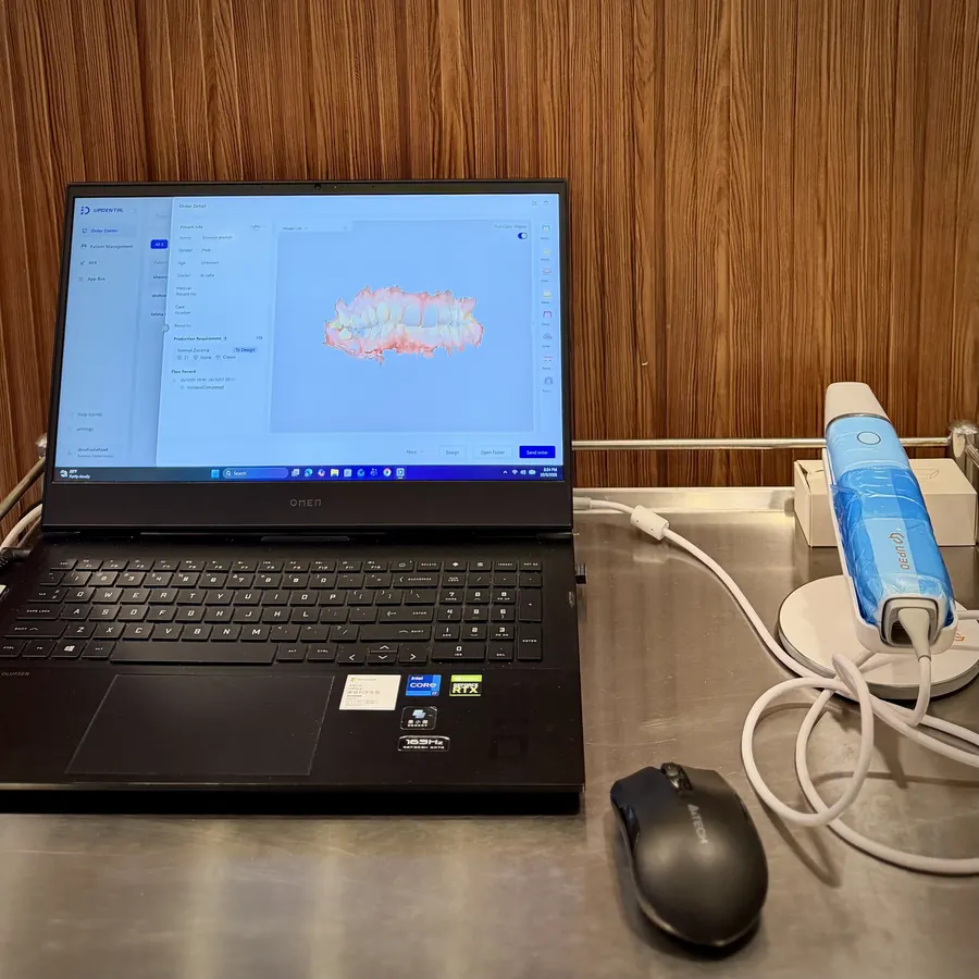 Intraoral scanner and a 3D scan of teeth on screen